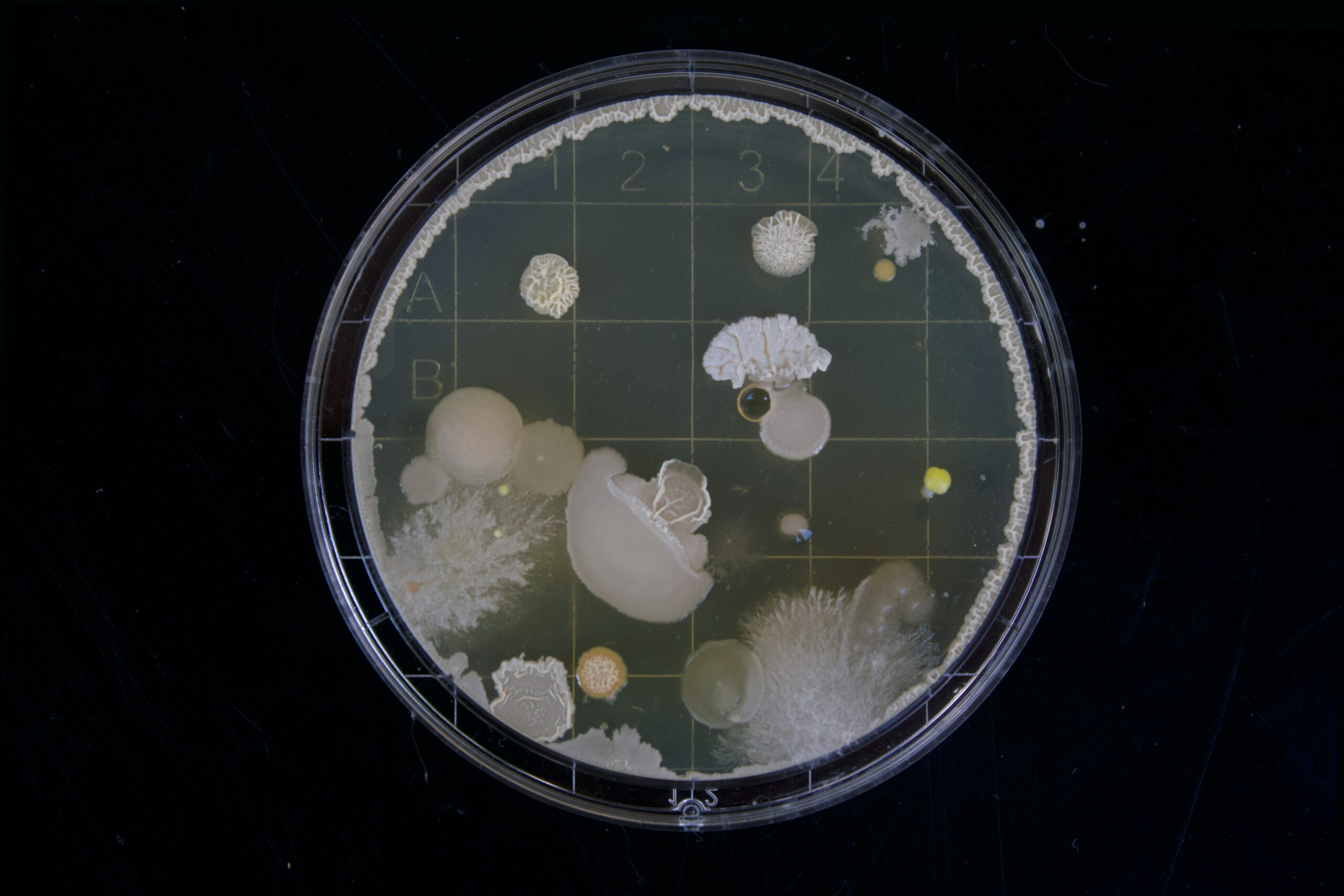 Test Μικροβιώματος – Ανάγκη ή περιττή πολυτέλεια;